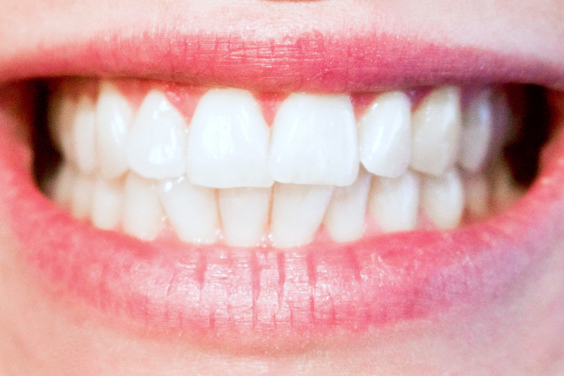 A close-up of a natural, healthy smile